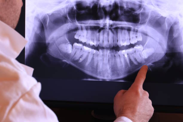 Best Emergency Dental Services for Seniors in San Felipe, TX