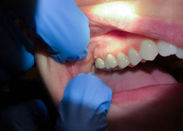Best Orthodontic Emergency Dentist in San Felipe, TX